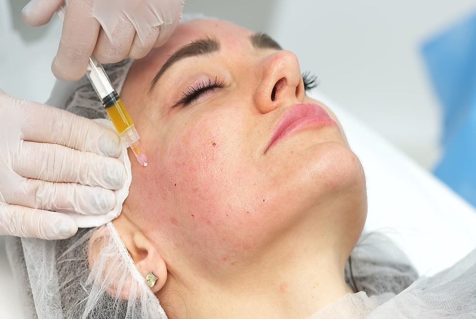 Quelle est la durée des résultats de PRP visage ?