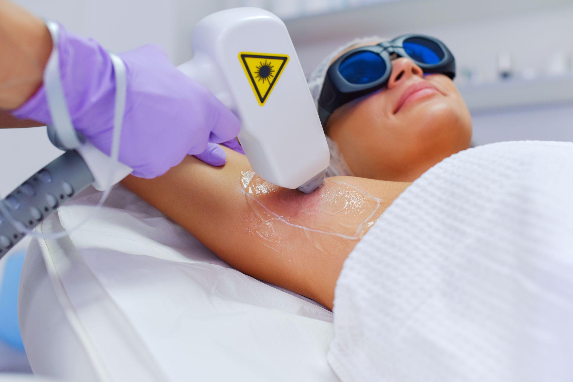 L'épilation laser est-elle cancérigène ? : on vous répond !