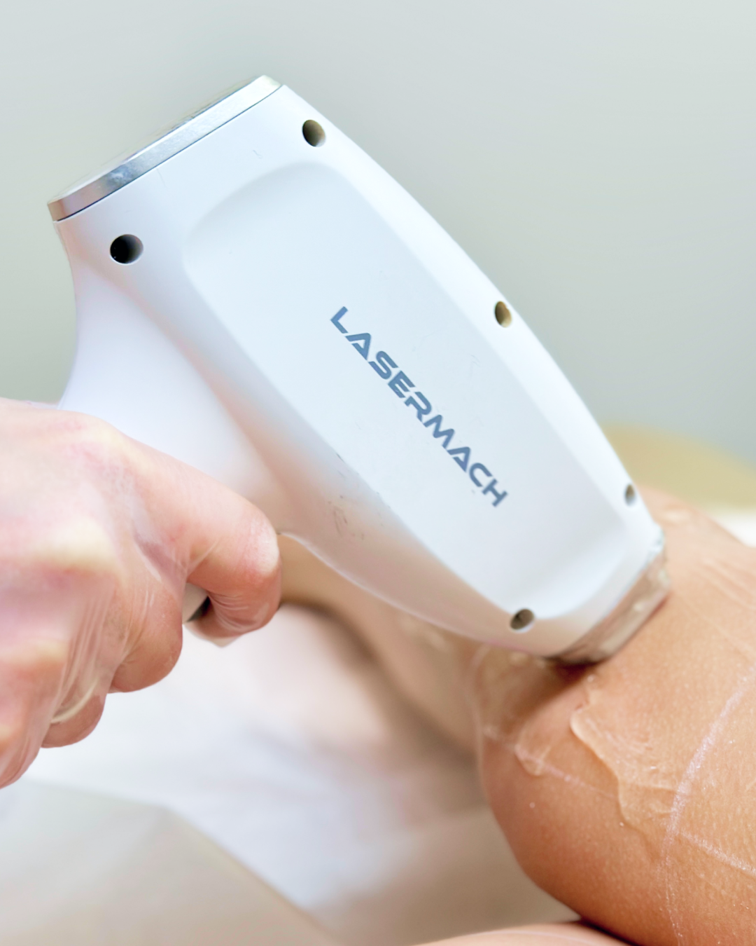 -50% sur 10 séances d’épilation laser pour 3 zones au choix