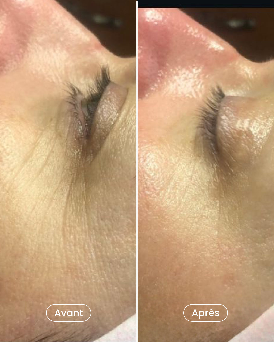 Choisissez votre soin de la peau à -30%