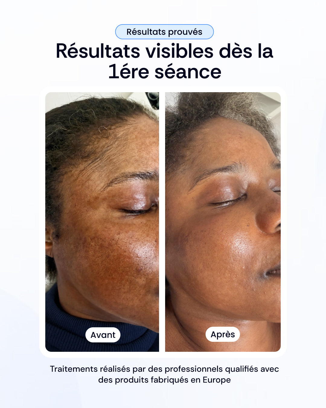 -30% sur nos soins de la peau