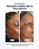 -30% sur nos soins de la peau