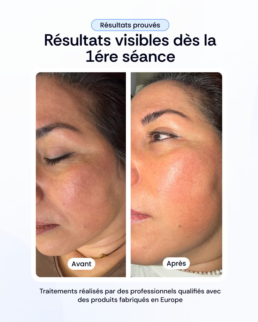 Choisissez votre soin de visage