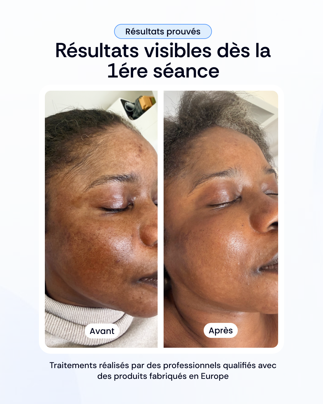 Choisissez votre soin de visage