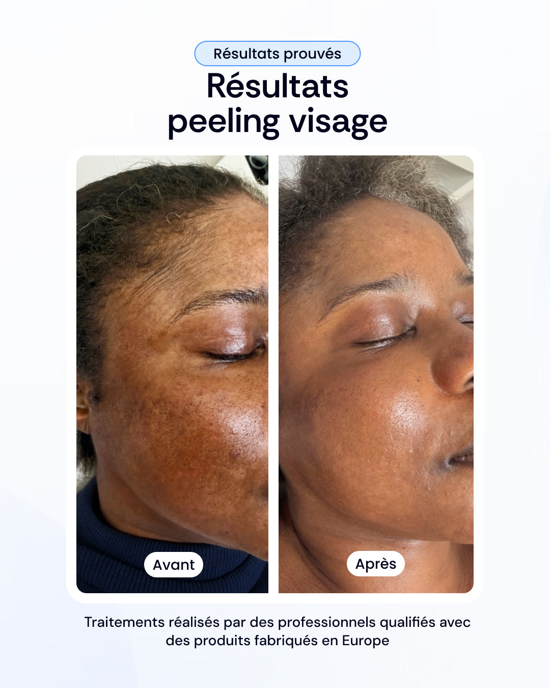 -30% sur nos soins de la peau