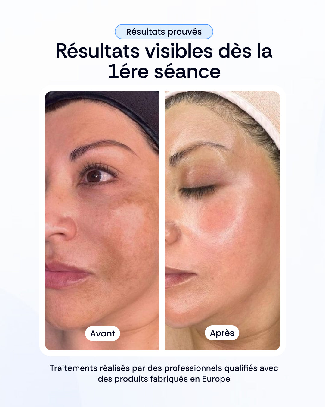 Pack nettoyage profond, peeling & luminothérapie visage