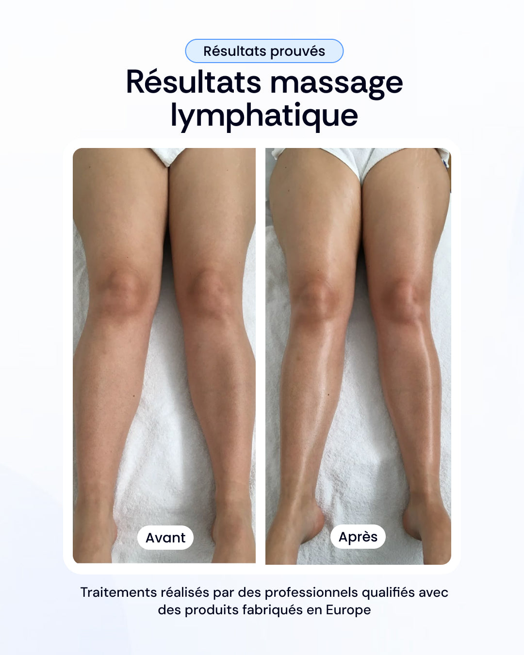 -30% sur nos soins de la peau