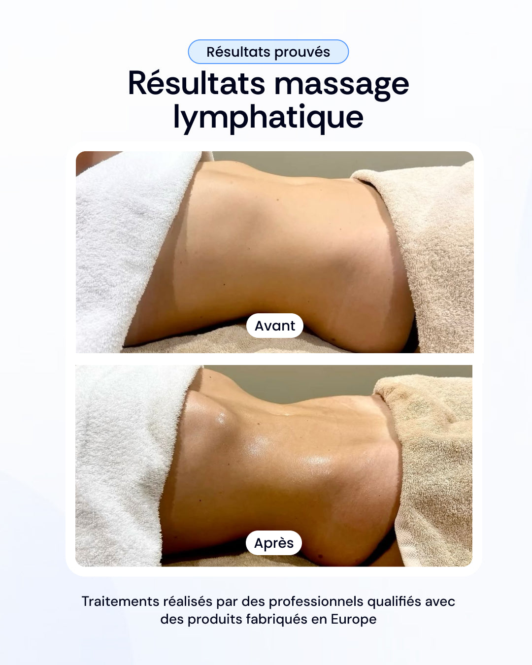 -30% sur nos soins de la peau