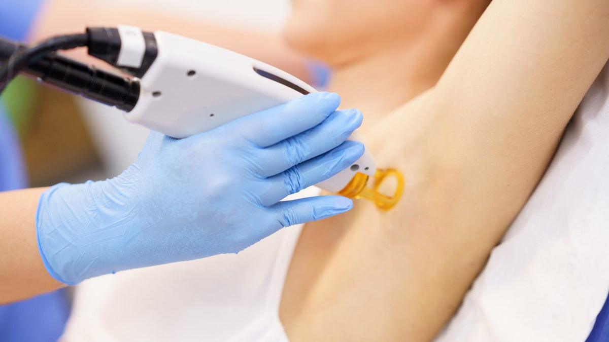 Douleur après une épilation laser : que faire ?