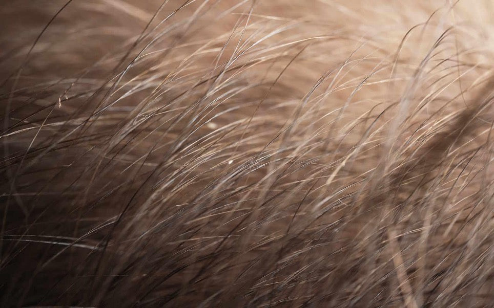 Permanent hair removal for white hair: laser or electrolysis? – SSSKIN