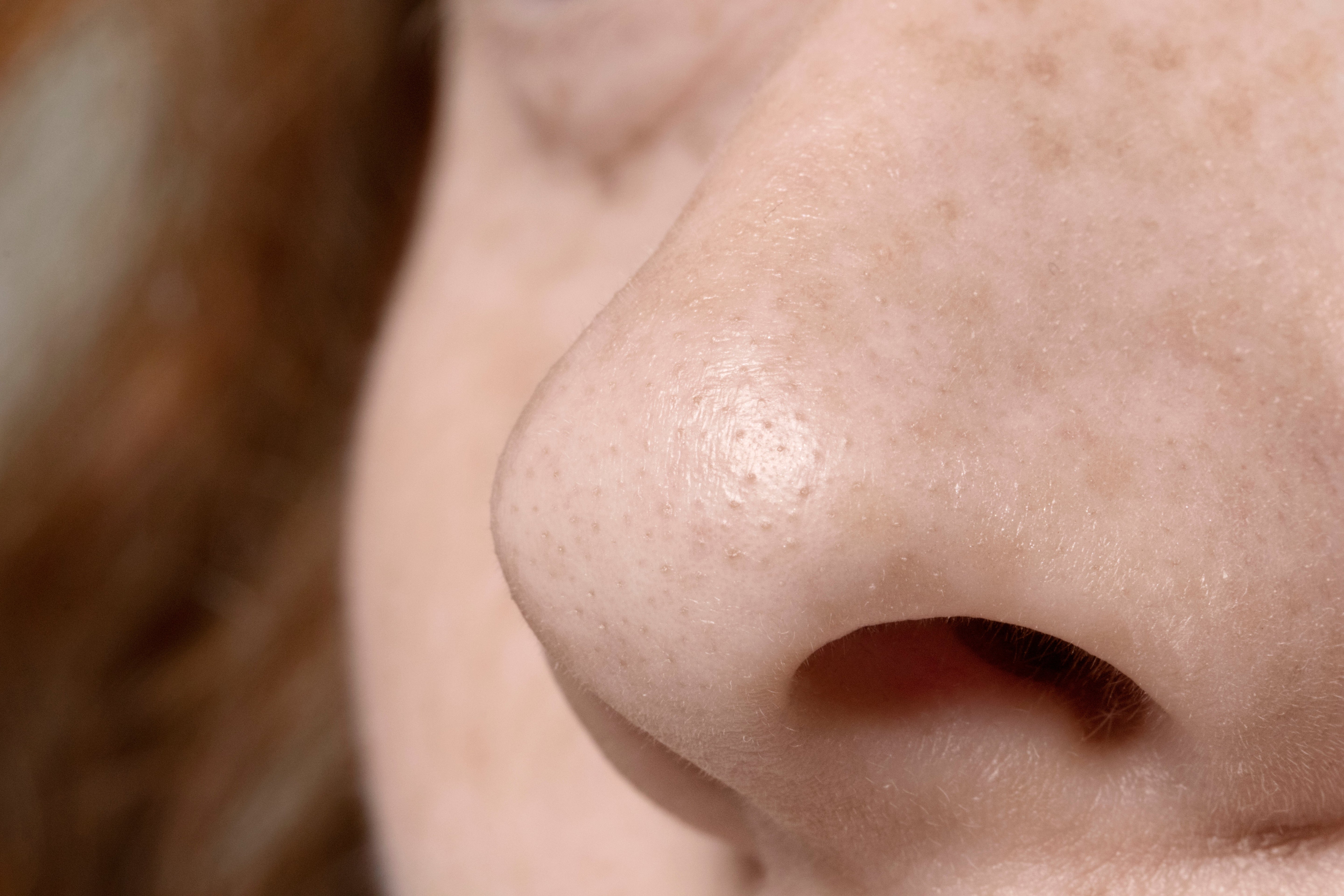 Secret de beauté : l'extraction manuelle