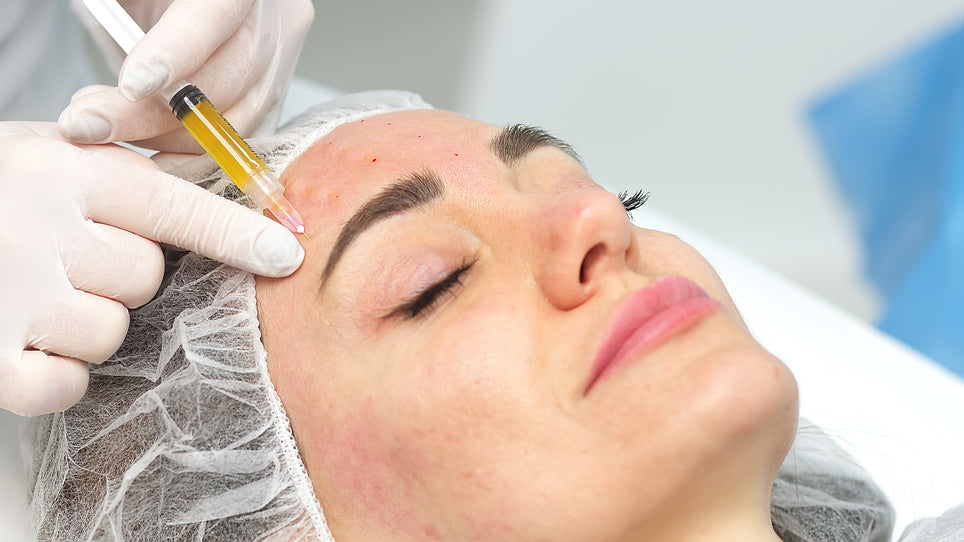 How to Prepare for Your PRP Facial Session: Dos and Don'ts – SSSKIN