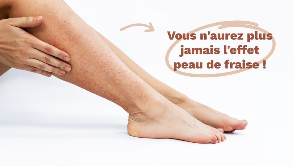 Éliminer l'effet peau de fraise avec l'épilation laser !