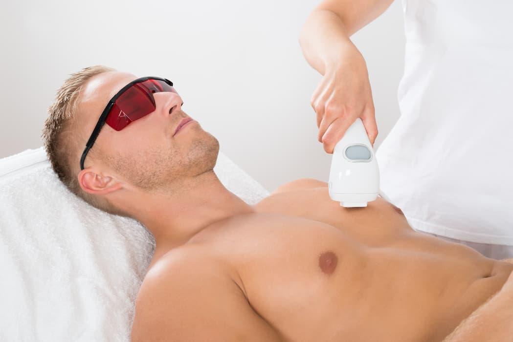 Tout savoir sur l’épilation laser pour homme : tarifs, âge, douleurs