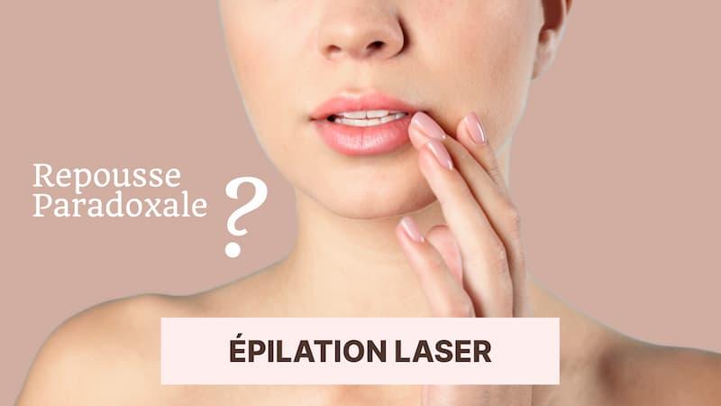 Comment éviter la repousse paradoxale après l'épilation laser ?