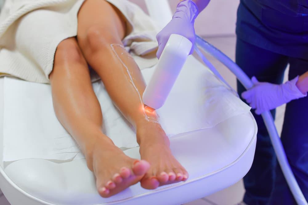 Épilation laser : quels résultats après votre première séance ?