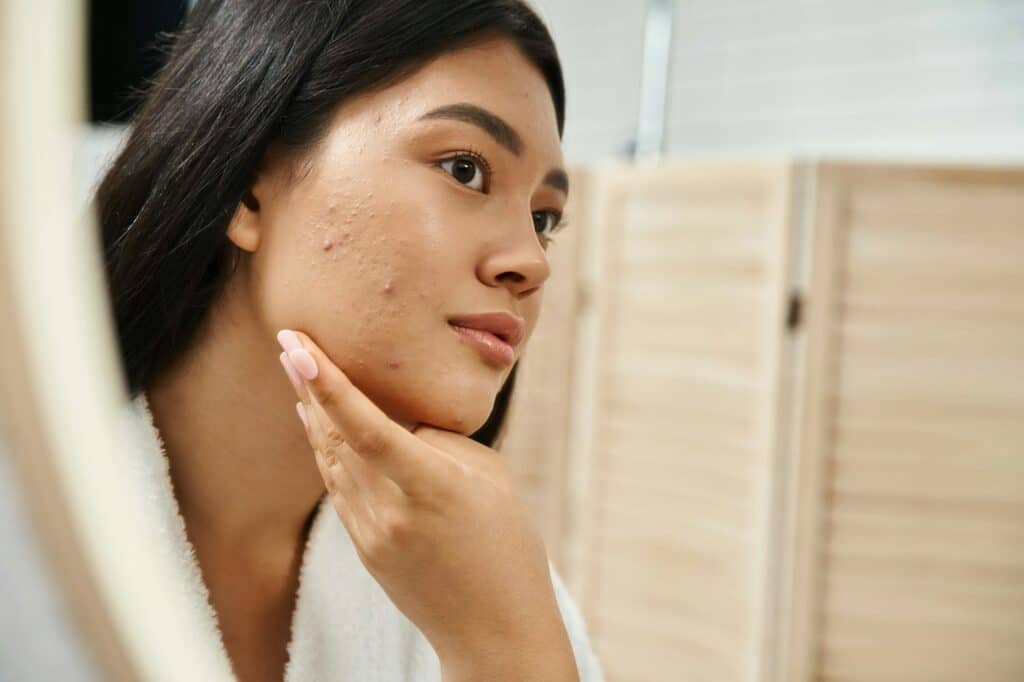 Microkystes (comédons fermés) : causes, soins et traitements efficaces