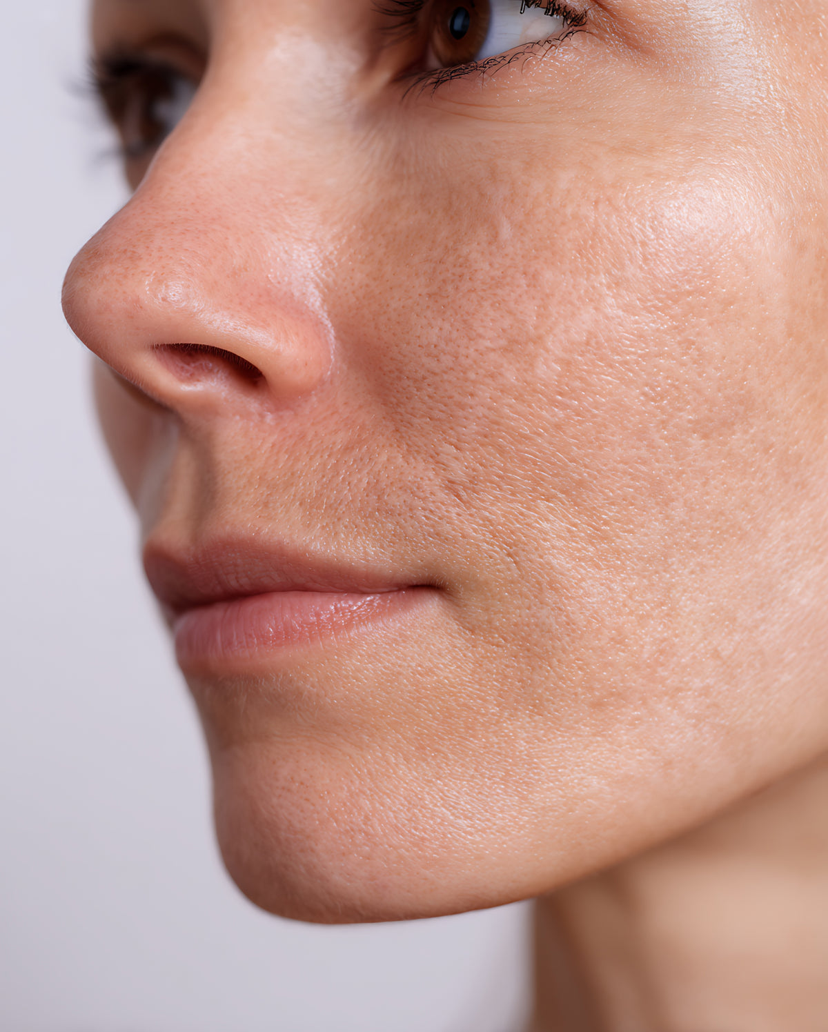 Zoom sur la texture d'une peau déshydratée, profil du visage