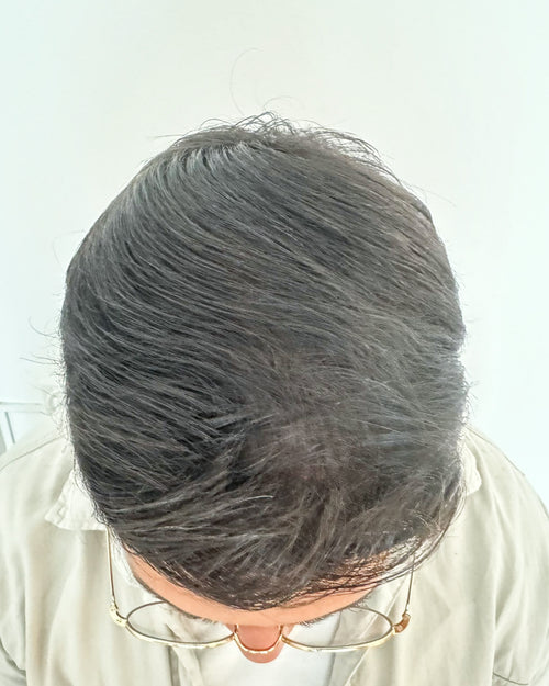 After treatment - Taha, 35 ans