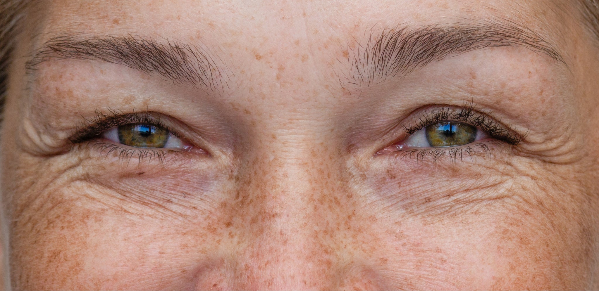 Ridules superficielles autour des yeux