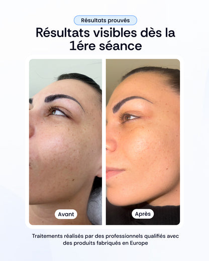 Pack nettoyage profond, peeling & luminothérapie visage