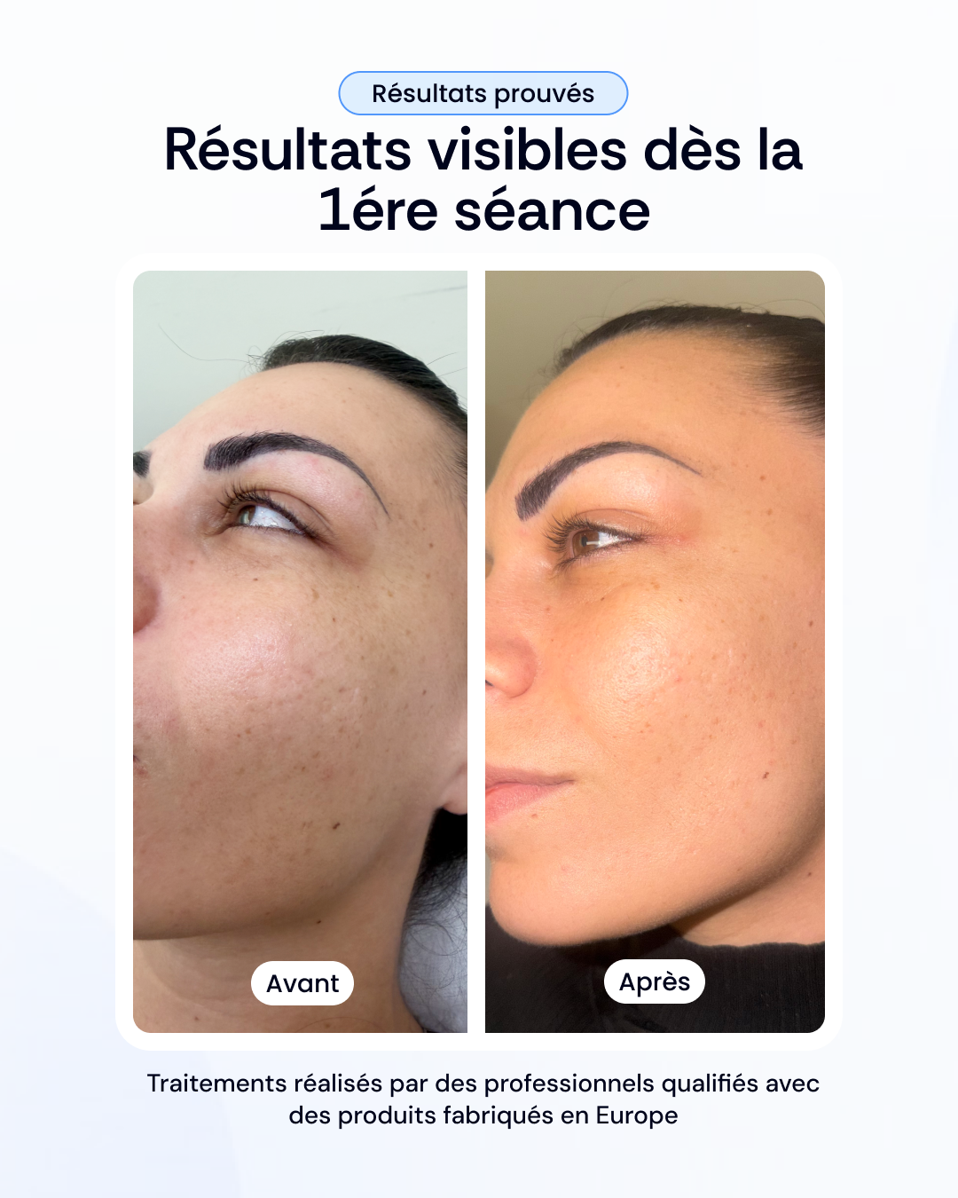 Choisissez votre soin de visage