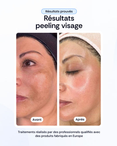 -30% sur nos soins de la peau
