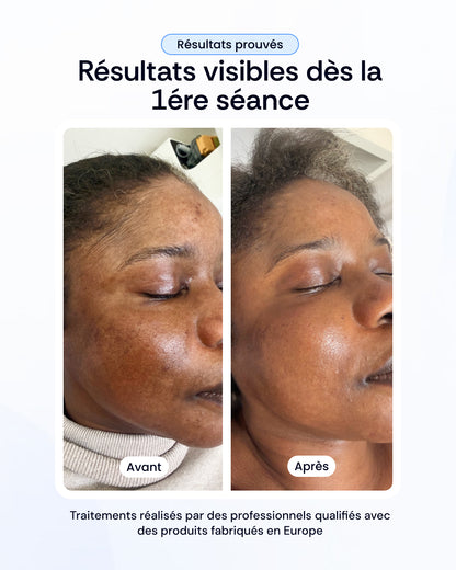 Pack nettoyage profond, peeling & luminothérapie visage