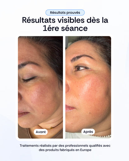 Pack nettoyage profond, peeling & luminothérapie visage