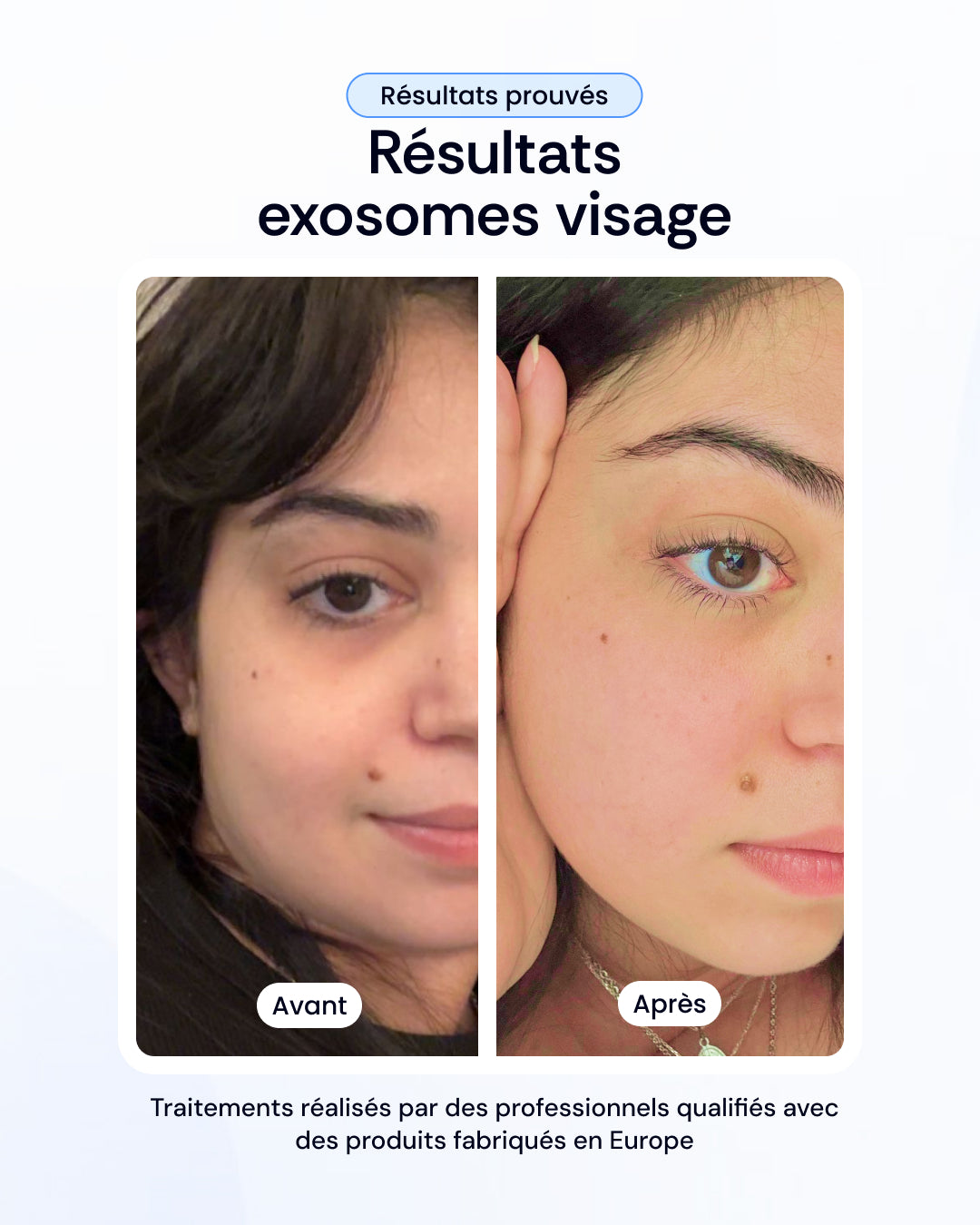-30% sur nos soins de la peau