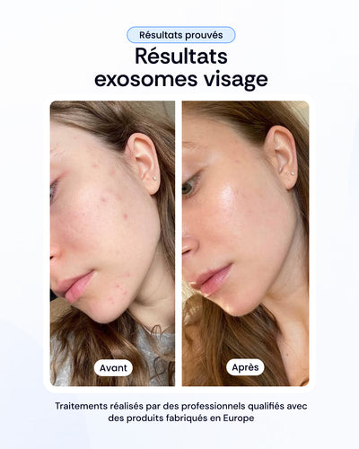 -30% sur nos soins de la peau