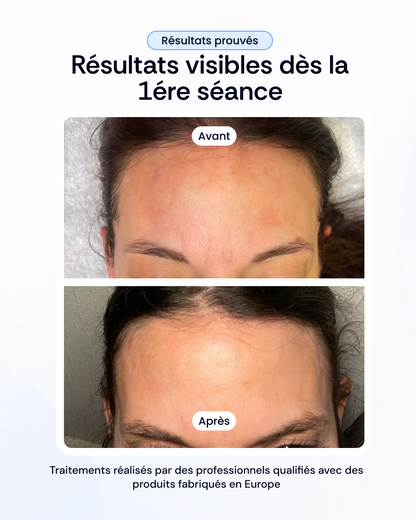 Peeling + Mésothérapy + Light Therapy Treatment
