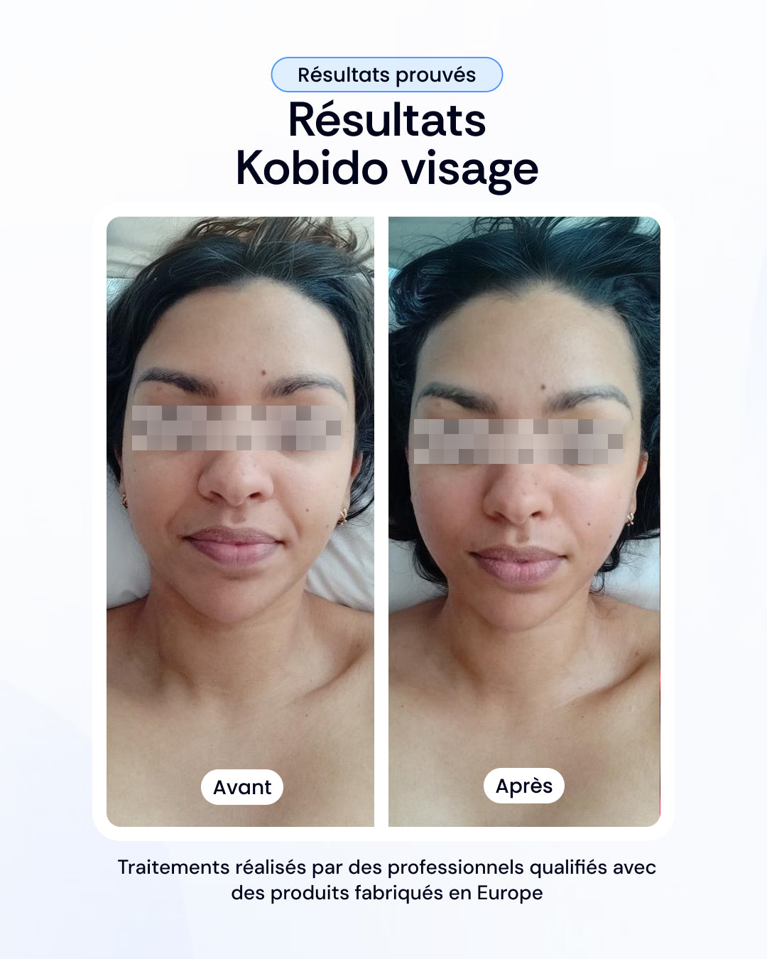 -30% sur nos soins de la peau