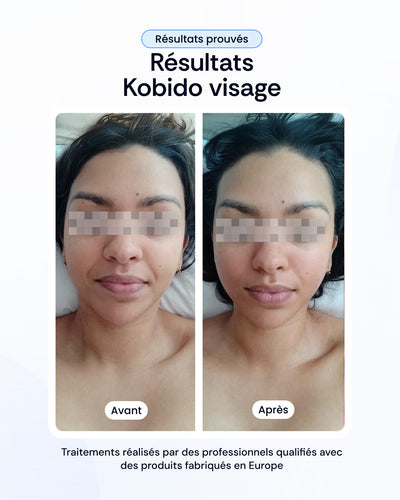 -30% sur nos soins de la peau