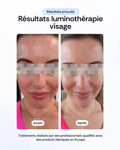 -30% sur nos soins de la peau