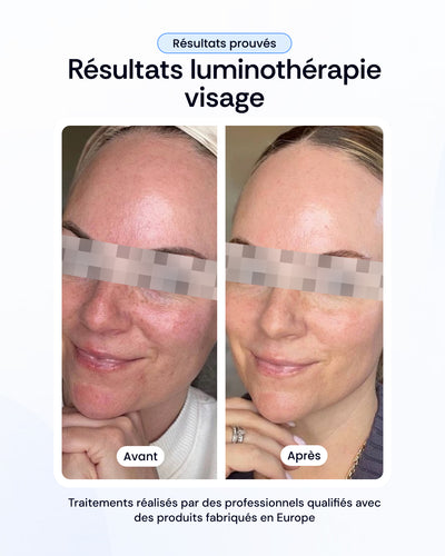 -30% sur nos soins de la peau
