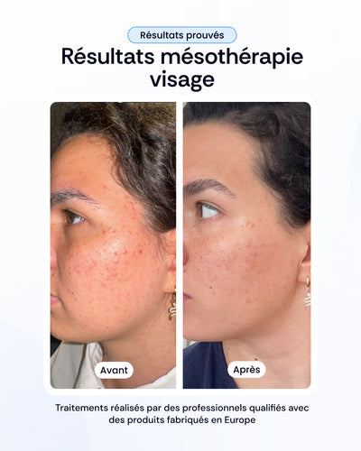 -30% sur nos soins de la peau