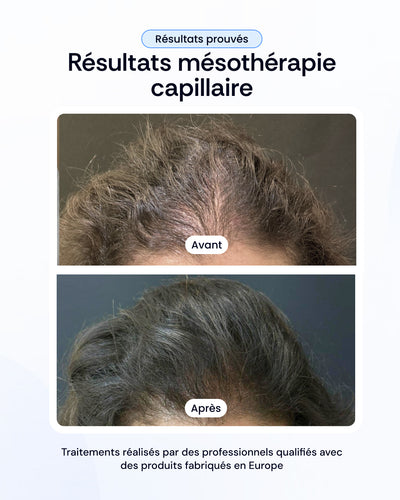 -30% sur nos soins de la peau