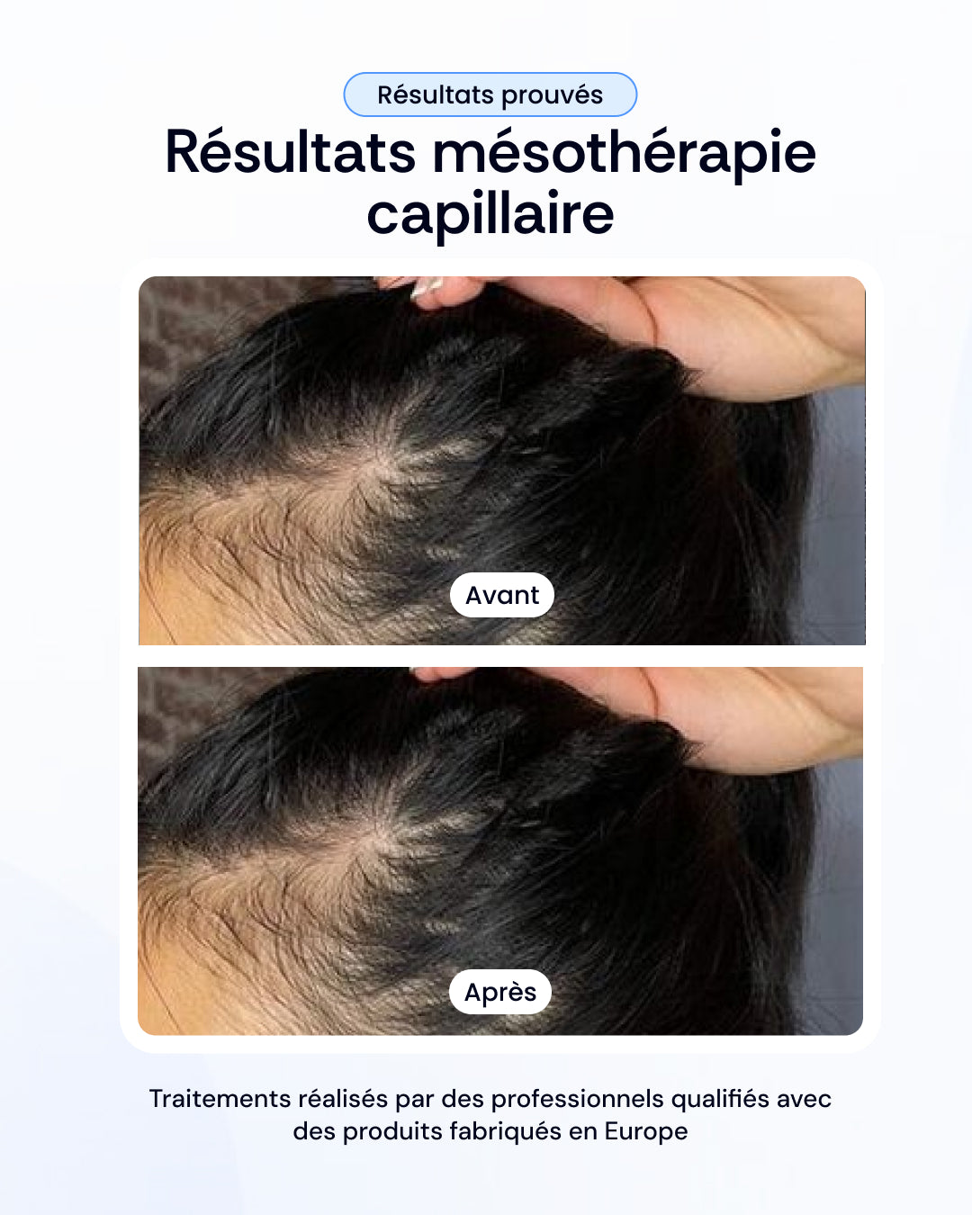 -30% sur nos soins de la peau