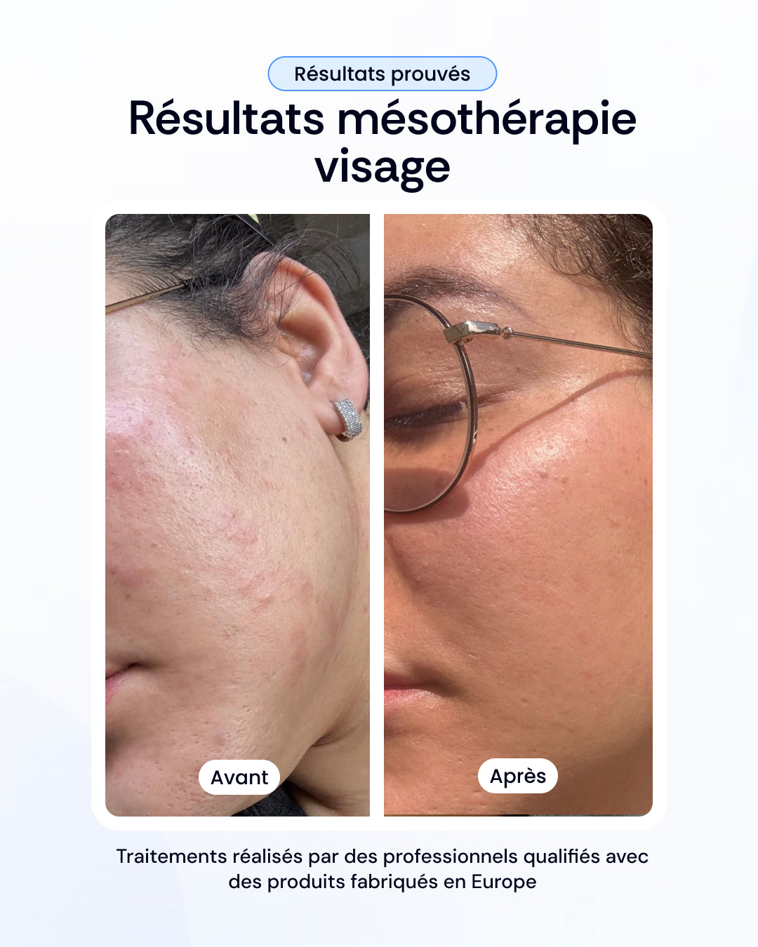 -30% sur nos soins de la peau