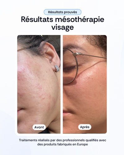 -30% sur nos soins de la peau