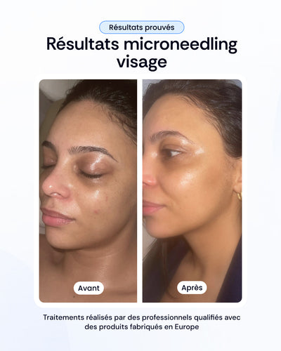 -30% sur nos soins de la peau