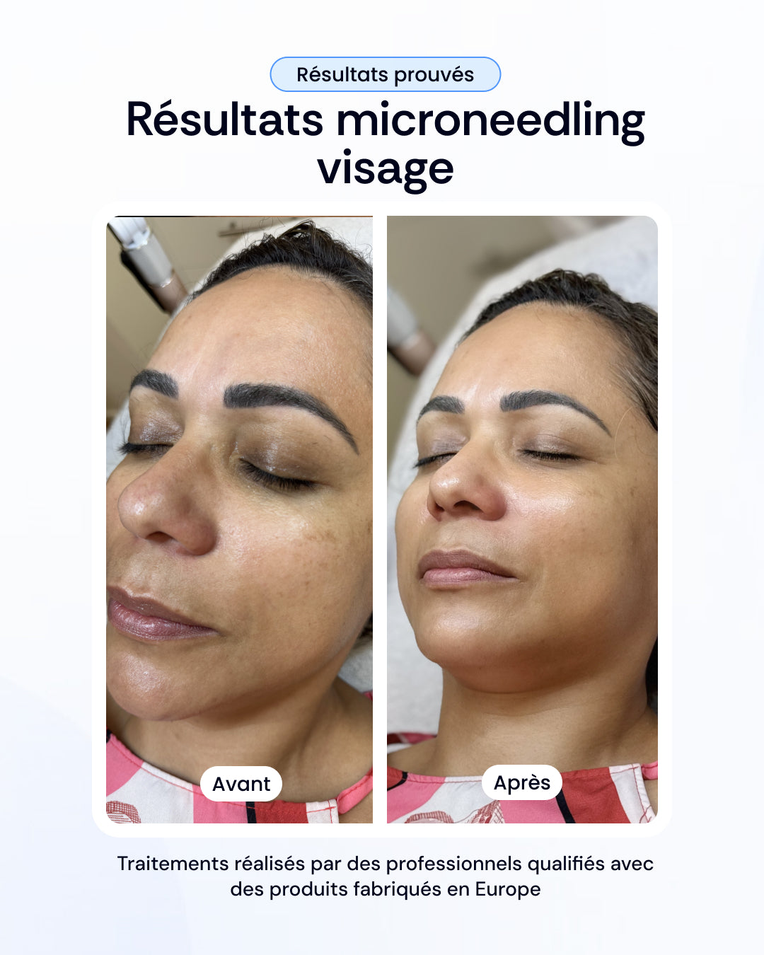 -30% sur nos soins de la peau